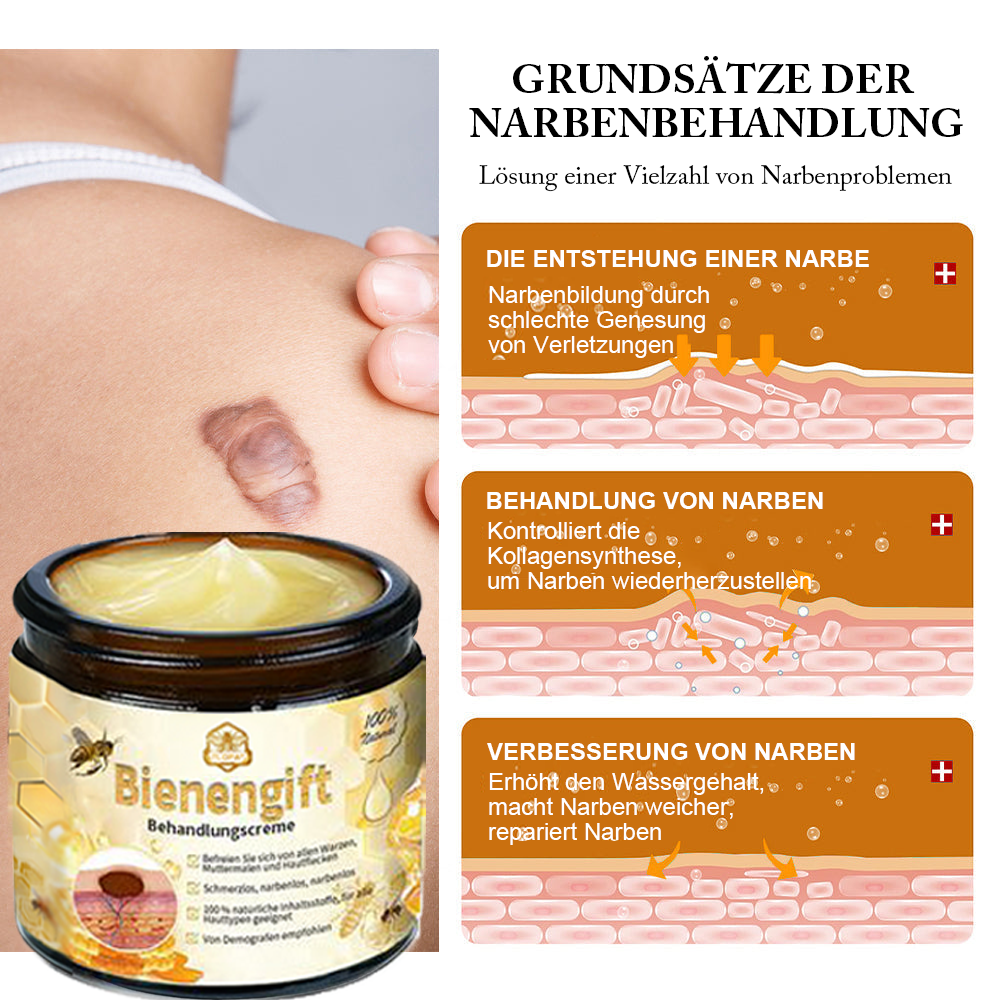 [Offizieller Laden] TLOPA® Fortgeschrittene Bienengift Behandlungscreme  (🔥Letzter Tag Aktion 80% Rabatt)