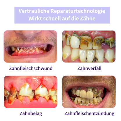 Cvreoz® Zahnreparatur-Mineralpuder💧(Empfohlen von der EAD)