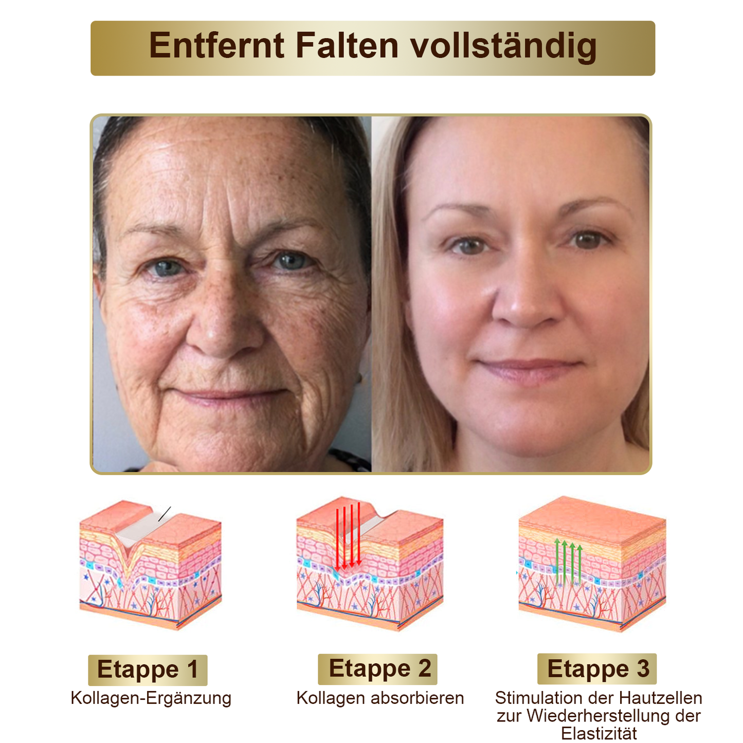 TLOPA® Starke Ganzkörper Haut behandlung creme🐝