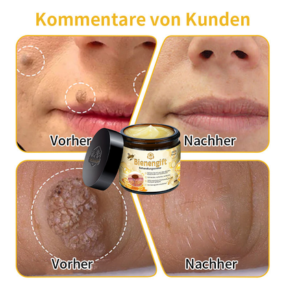 [Offizieller Laden] TLOPA® Fortgeschrittene Bienengift Behandlungscreme  (🔥Letzter Tag Aktion 80% Rabatt)