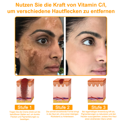 TLOPA®  7-Tage-Multi-Effekt-Schnell-Hautreparaturcreme – Professionell unterstützt von der DDG 🌼👨‍⚕️