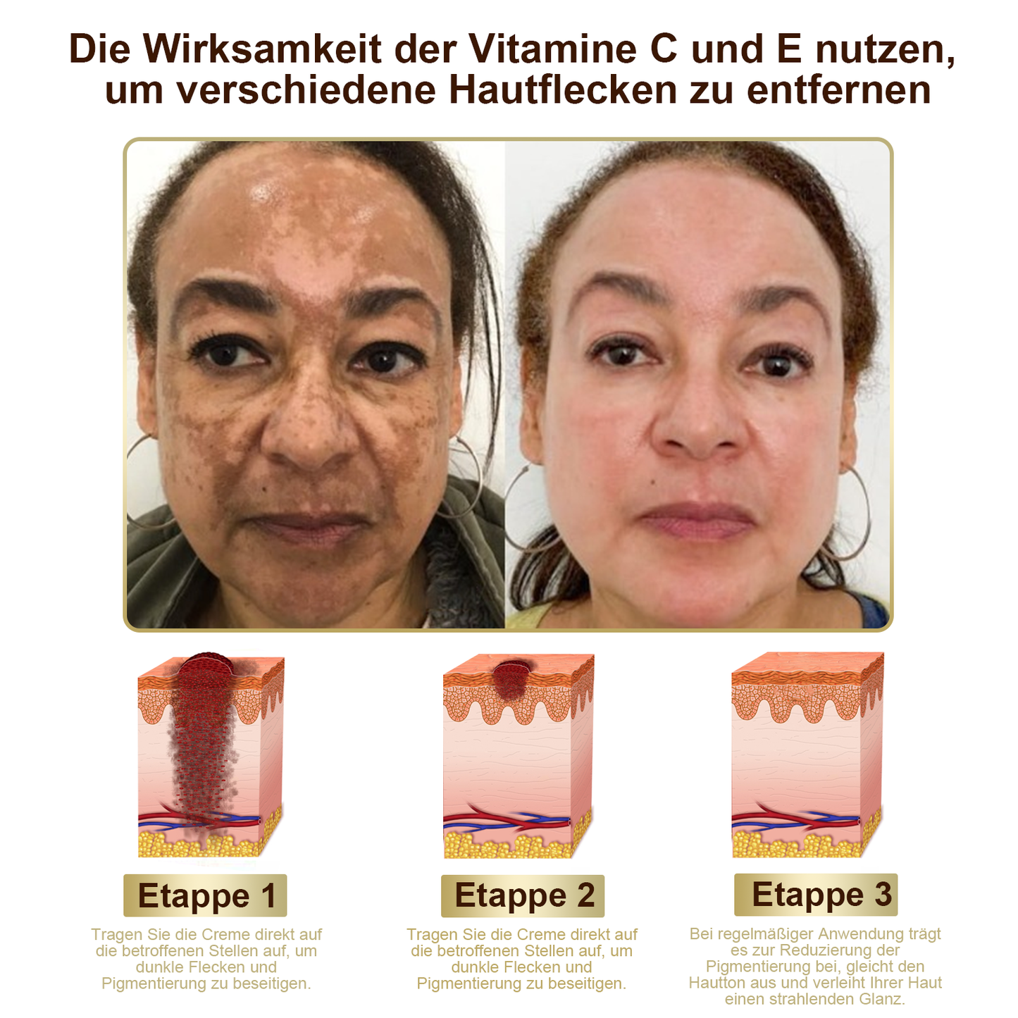 TLOPA® Starke Ganzkörper Haut behandlung creme🐝