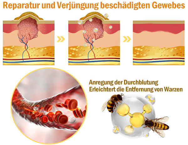 TLOPA® Starke Ganzkörper Haut behandlung creme🐝