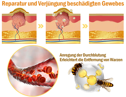 TLOPA® Starke Ganzkörper Haut behandlung creme🐝