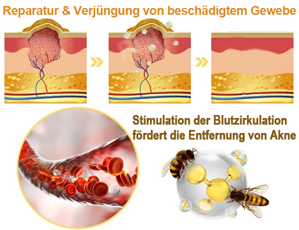 TLOPA®  7-Tage-Multi-Effekt-Schnell-Hautreparaturcreme – Professionell unterstützt von der DDG 🌼👨‍⚕️