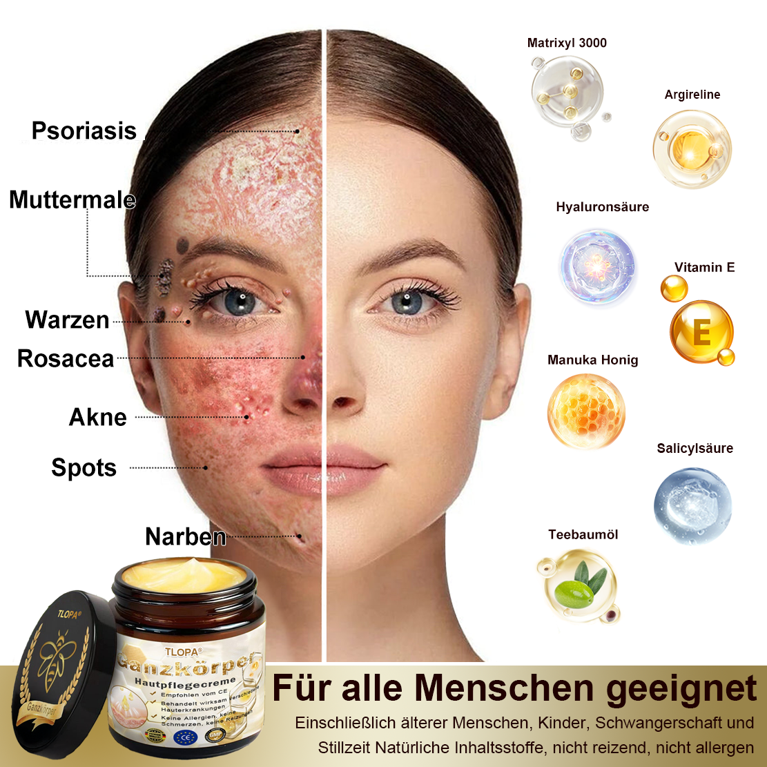 TLOPA® Starke Ganzkörper Haut behandlung creme🐝